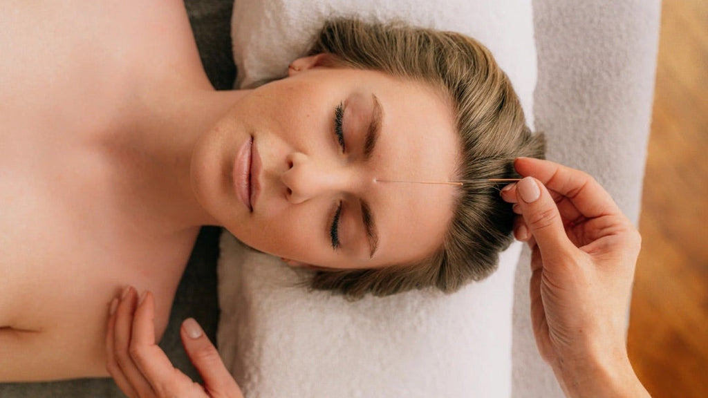 Kosmetisk akupunktur 60 min.